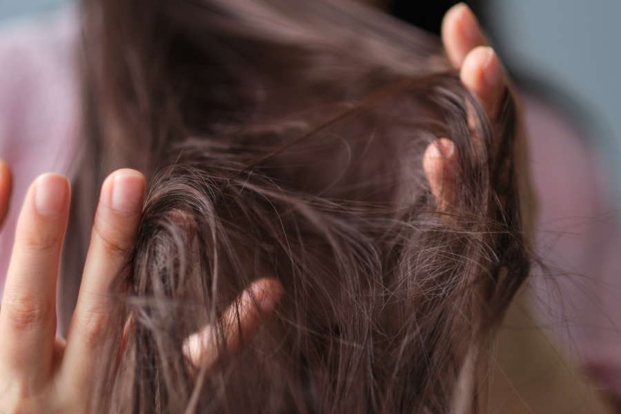 Dermatillomania